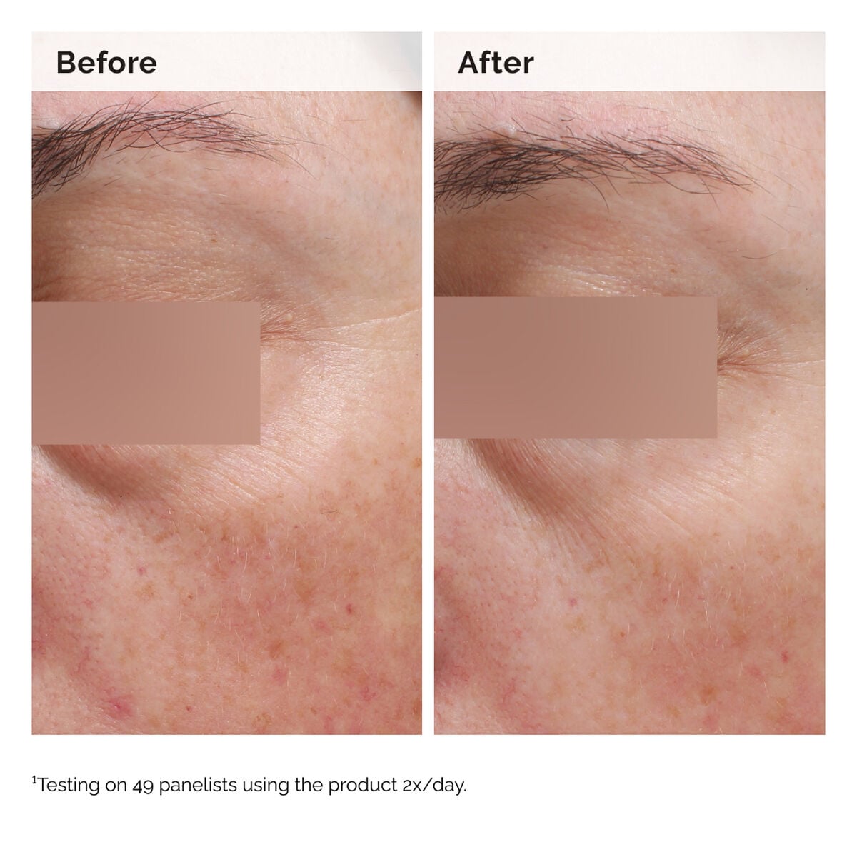 niacinamide-5-face-and-body-emulsion-f5 2024-08-23-ORD-Nia-5pct-Face-Body-B-A-Elasticity-Global-02-1x1.jpg