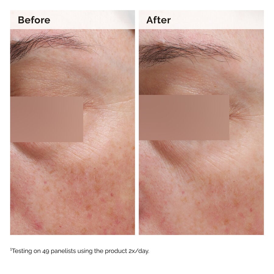 niacinamide-5-face-and-body-emulsion-f5 2024-08-23-ORD-Nia-5pct-Face-Body-B-A-Elasticity-Global-02-1x1.jpg