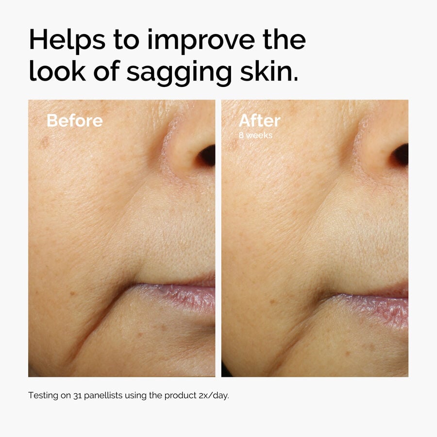 caffeine-3-escin-1-face-serum-u4 ord-caffeine-3pct-escin-1pct-face-serum-before-after-sagging.jpg