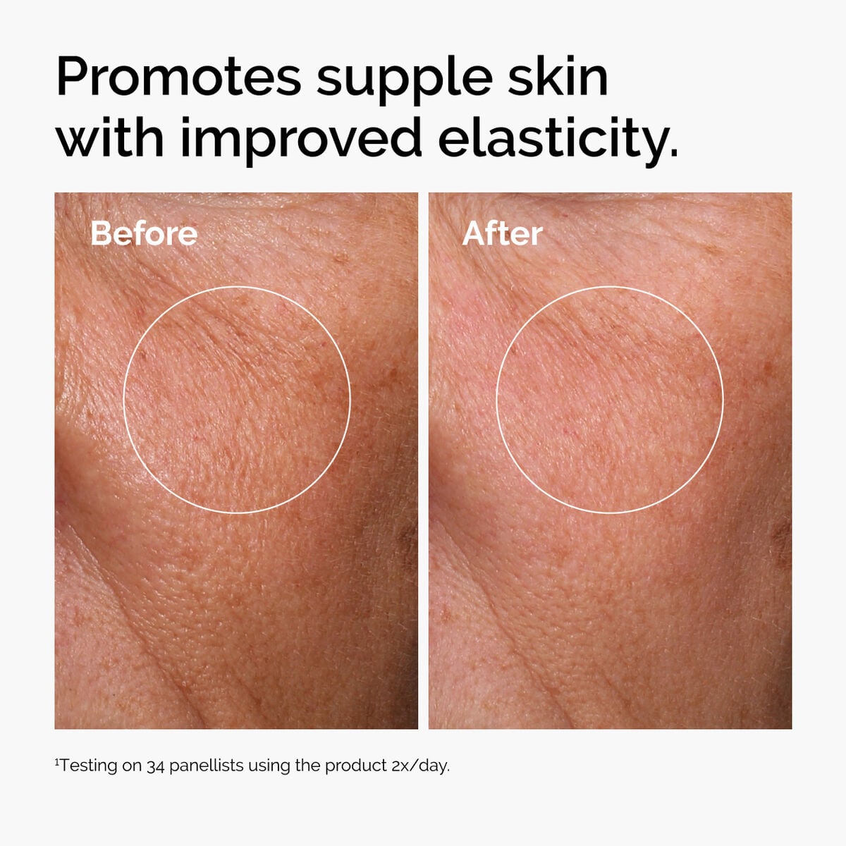 hyaluronic-acid-2-b5-with-ceramides-q4 ord-hyaluronic-acid-2pct-b5-hydrating-serum-before-after-elasticity.jpg
