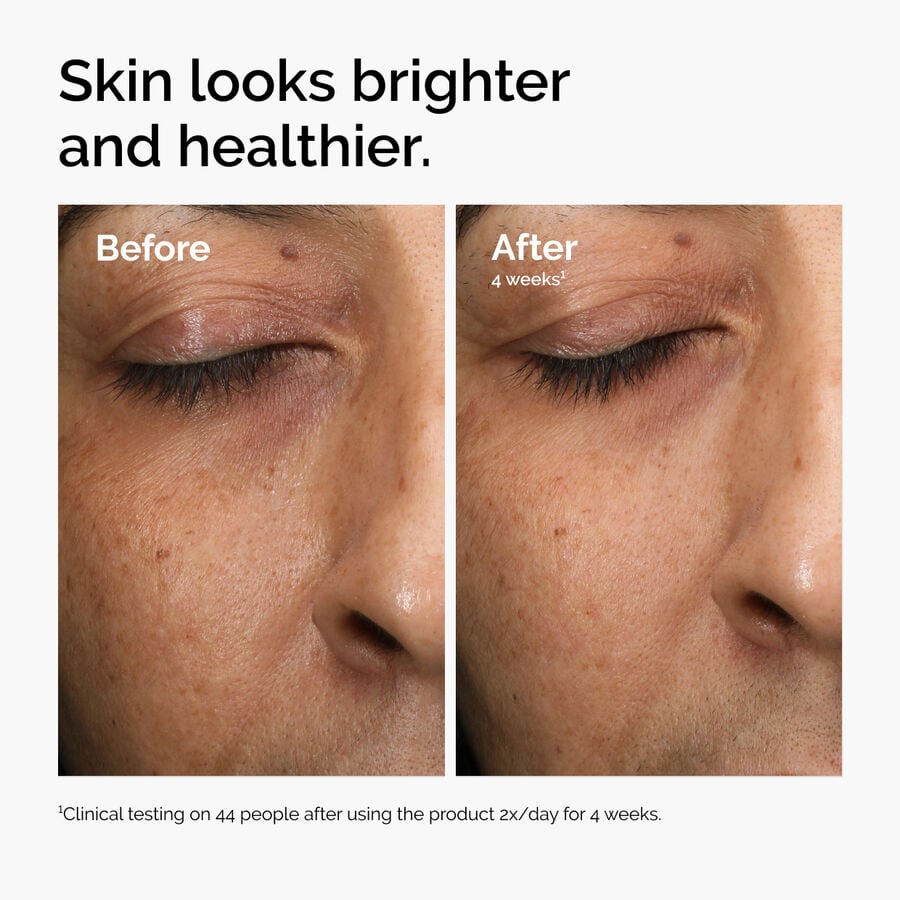 multi-antioxidant-radiance-serum-t9 ord-mars-before-after-healthy.jpg
