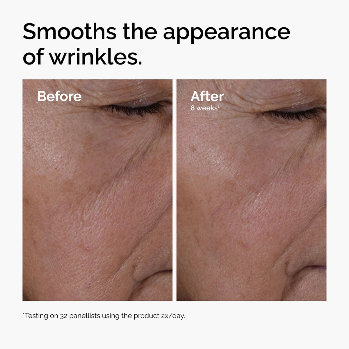 multi-peptide-ha-serum-g4 ord-multi-peptide-ha-serum-wrinkles-before-after.jpg