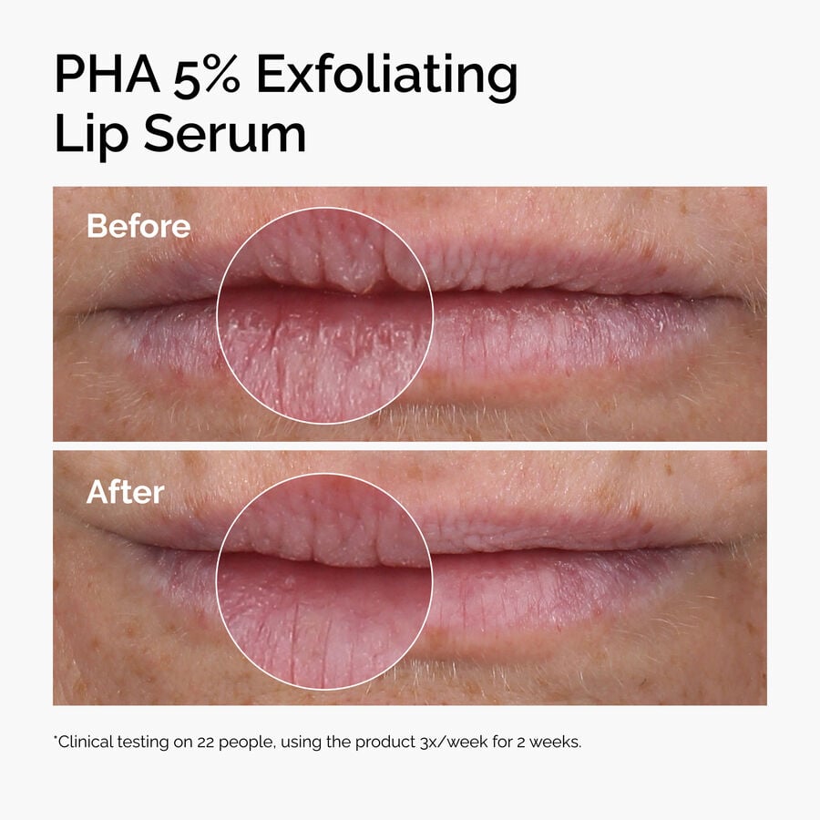 pha-5-exfoliating-lip-serum-o3 ord-pha-5pct-lip-exfoliating-serum-before-after.jpg